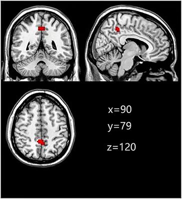 Decreased Connectivity in Precuneus of the Ventral Attentional Network in First-Episode, Treatment-Naïve Patients With Major Depressive Disorder: A Network Homogeneity and Independent Component Analysis